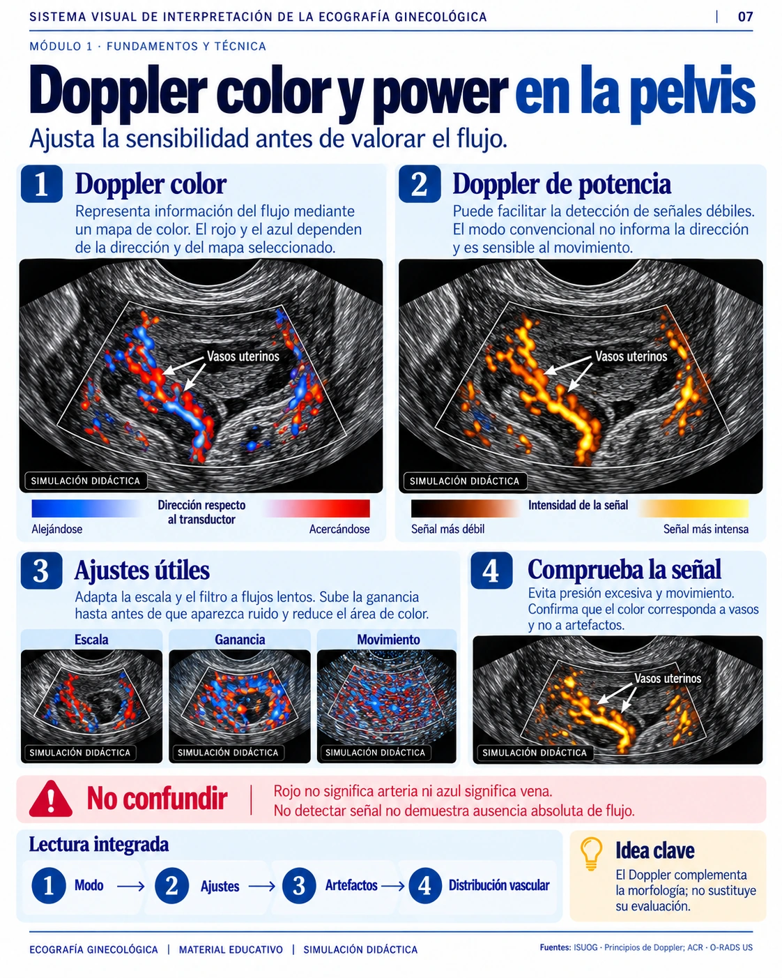 Doppler color y power en la pelvis